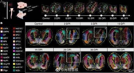 全球首个脑再生时空图谱揭秘大脑自行恢复过程 (图2)